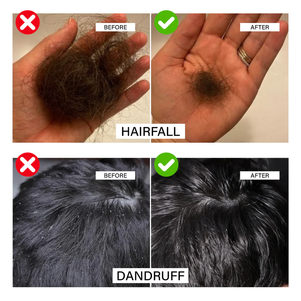 Scalp Improvement Before After
