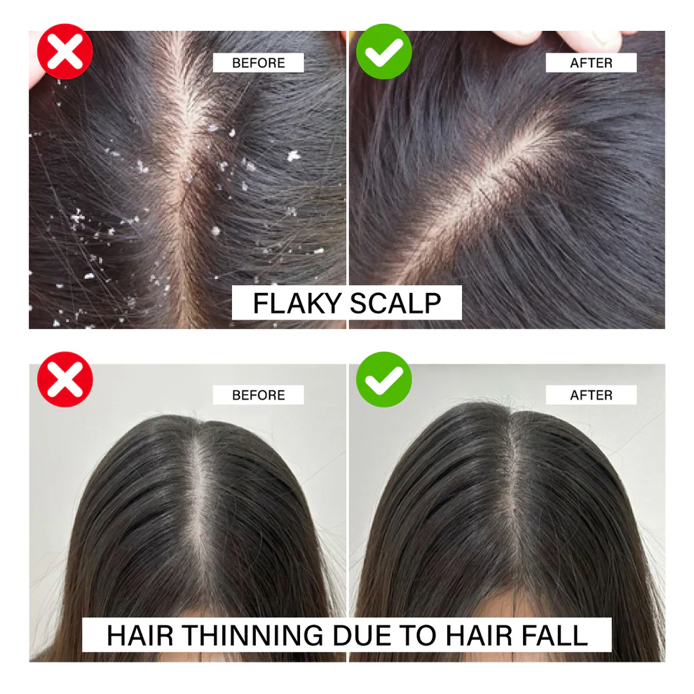 Hair Fall Control Before After
